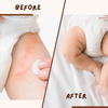 Coco Crush Rash Oil For Babies - Diaper & Nappy Rash Relief | Organic | Prevents Irritation - 200Ml