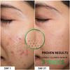 Sereko Oil Clear Face Moisturizer With Nmf For Oily & Acne-Prone Skin | Minimizes Pores 50 Ml