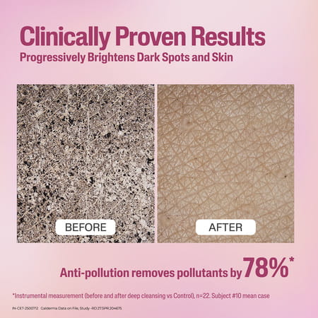 Cetaphil Bright Healthy Radiance Gentle Renewing Cleanser | 100 Gm