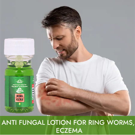 Cipzer Ring Cure Lotion 20Ml Anti Itching For Ring Worms & All Type Skin Disease