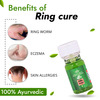 Cipzer Ring Cure Lotion 20Ml Anti Itching For Ring Worms & All Type Skin Disease