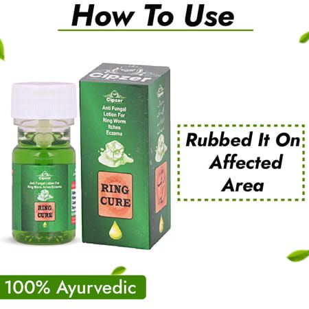 Cipzer Ring Cure Lotion 20Ml Anti Itching For Ring Worms & All Type Skin Disease