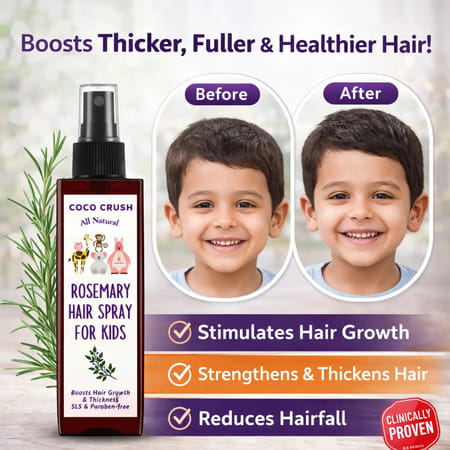 Coco Crush Rosemary Hair Spray For Kids Hair Growth 200Ml | Hair Fall Control For Children