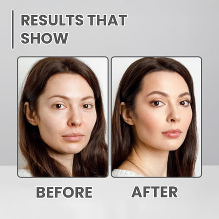 Alglaze White Lily Face Wash | Niacinamide| Hyaluronic Acid & Vitamin B5 | All Skin Types | 100Ml