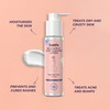 Sanfe Back & Bum Acne Clearing Lotion With Shea Butter & Peach Extracts - 100Ml