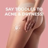 Sanfe Back & Bum Acne Clearing Lotion With Shea Butter & Peach Extracts - 100Ml