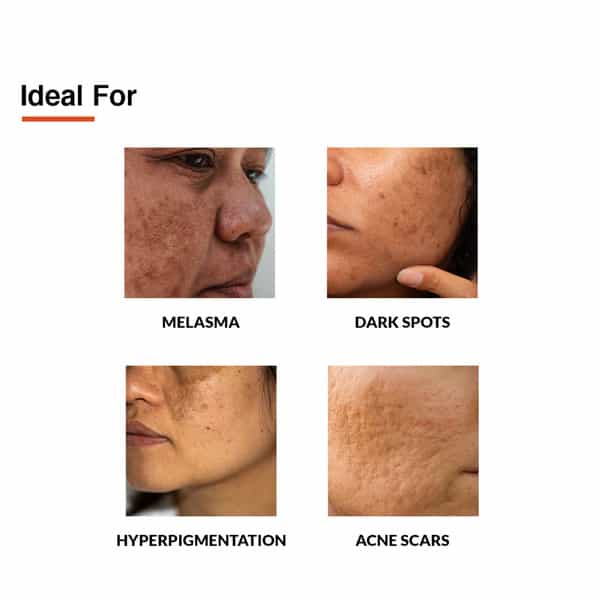 Fixderma Skarfix -Tx Cream 30Gm