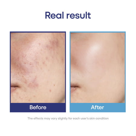 Hyalugel Plus Gel 30gm