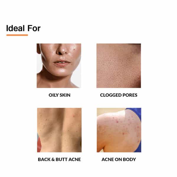 Salyzap Spray 50Ml