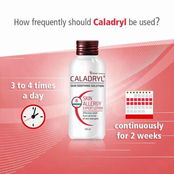 Caladryl Skin Allergy Expert Calamine Lotion- Skin Soothing Solution - 60 Ml