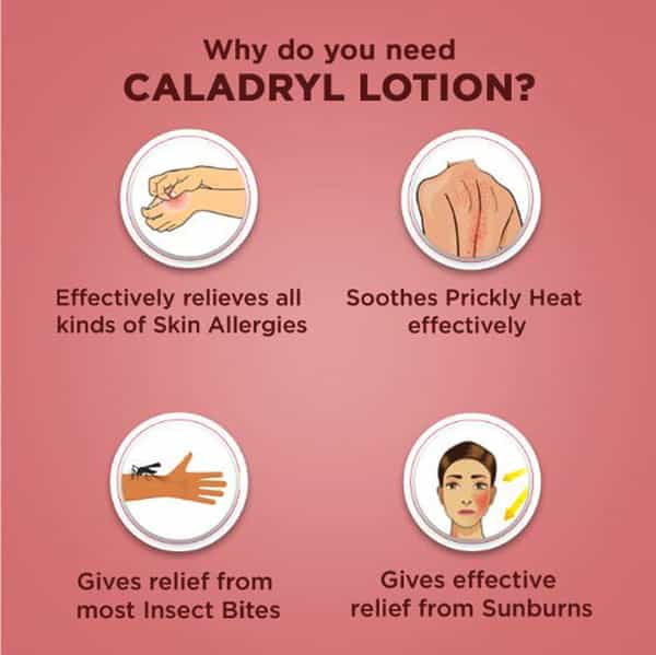 Caladryl Skin Allergy Expert Calamine Lotion- Skin Soothing Solution - 60 Ml
