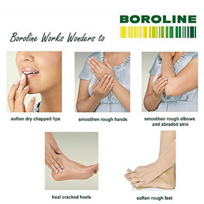 View product image 2