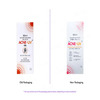 Acne Uv Advanced Light Protection Spf 50+ Pa+++ Sunscreen Gel 50 Gm
