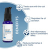 Fcl Alpha Beta Acne Gel 30Ml