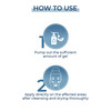 Fcl Alpha Beta Acne Gel 30Ml
