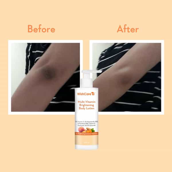 Wishcare Multi-Vitamin Brightening Body Lotion - Vitamin C | Niacinamide(B3) | Panthenol(B5) (200Ml)