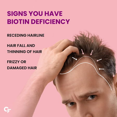 Carbamide Forte Biotin 10000mcg 60 Tablets