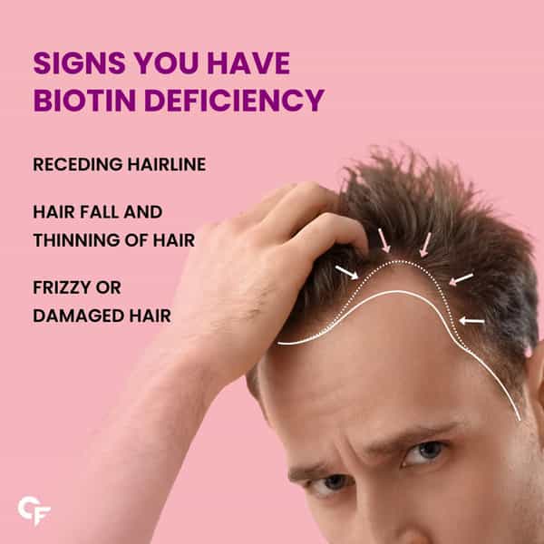 Carbamide Forte Biotin 10000Mcg 60 Tablets