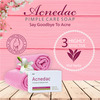 Acnedac Antiacne & Antipimple Soap 75 Gm | Aloe & Salicylic Acid (Pack Of 2)
