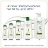 Dove Hair Fall Rescue Shampoo - 340 Ml