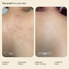 Arata Smoothening Body Wash | Bacne & Bumpy Skin | Salicylic & Glycolic | 250 Ml