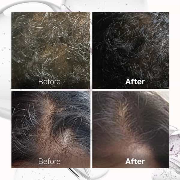Bontress Pro+ Scalp Serum | 5% Capixyl | 3% Redensyl | 3% Anagain | 3% Procapil | 60 Ml