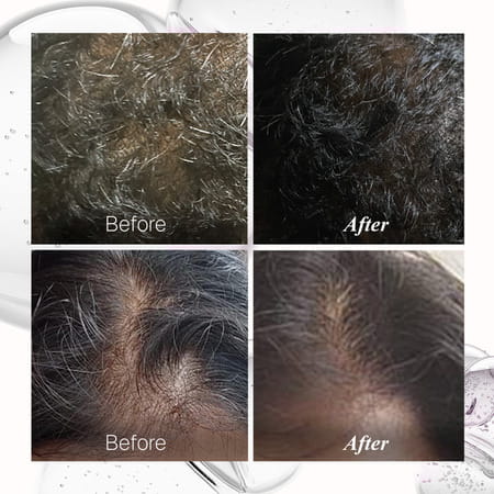 Bontress Pro+ Scalp Serum | 5% Capixyl | 3% Redensyl | 3% Anagain | 3% Procapil | 60 Ml