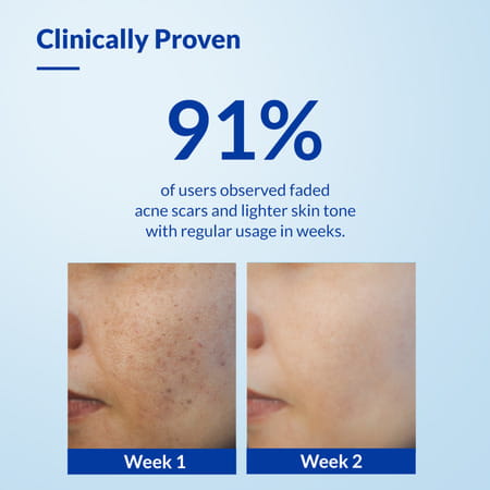 Fixderma Skarfix-Tx Face Cleanser With Tranexamic Acid, Kojic Acid & Niacinamide Face Wash 75 Gm