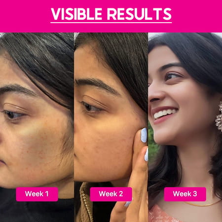 Cos-Iq Abp 33% Strong Exfoliating Peel Aha 25% | Pha 6% | Bha 2% Peeling Solution