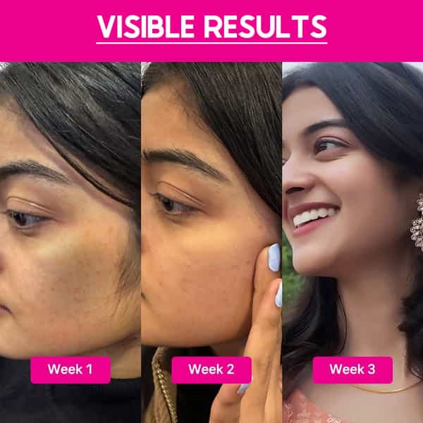 Cos-Iq Abp 33% Strong Exfoliating Peel Aha 25% | Pha 6% | Bha 2% Peeling Solution