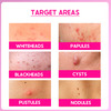 Cos-Iq Abp 33% Strong Exfoliating Peel Aha 25% | Pha 6% | Bha 2% Peeling Solution