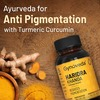Gynoveda Anti Pigmentation Turmeric Curcumin Skin Care Say No To Acne 1 Bottle 240 Tablets