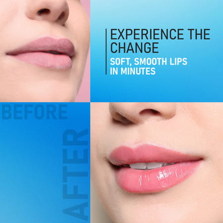Yuthika Lip Care Balm 10G Pack Of 12 | Intense Moisture | Soft Touch Lip Balm (Jar Pack)