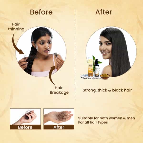 The Skin Story 100% Natural Ayurvedic Hair Oil With Amla For Hair Growth | Reduced Hair Fall 100Ml