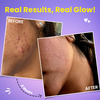 Chicnutrix Glow - Glutathione & Vitamin C - Skin Radiance & Glow | 10 Tablets (Strawberry Lemon)