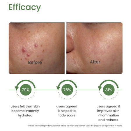 Earth Rhythm Cica Gel - 100 Gm