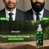 Sheopal's Beard Growth Oil Pro+ | For Uneven & Fast Growth | 50Ml | Pack Of 1