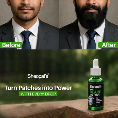 Sheopal'S Beard Growth Oil Pro+ | For Uneven & Fast Growth | 50ml | Pack Of 1