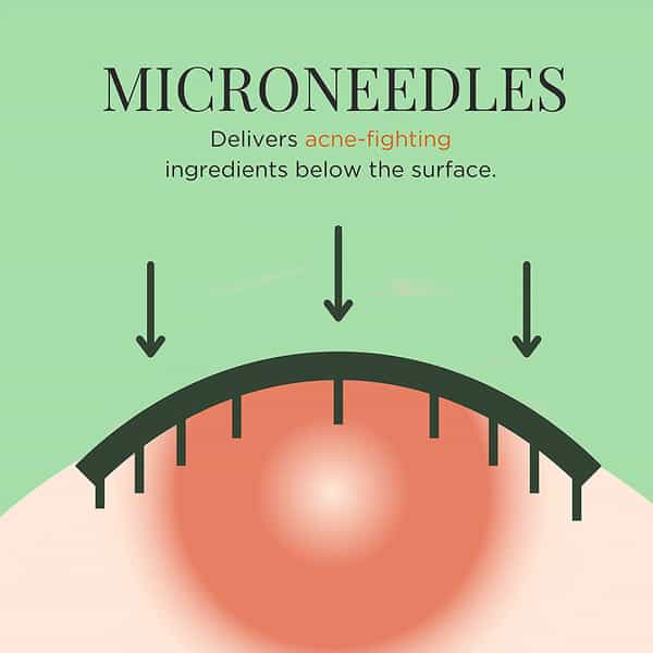 Azah Microneedle Acne Patch For Quick Acne | Scarring | & Blemish Treatment|9 Patches (10 Ml)