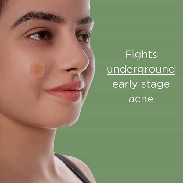Azah Microneedle Acne Patch For Quick Acne | Scarring | & Blemish Treatment|9 Patches (10 Ml)