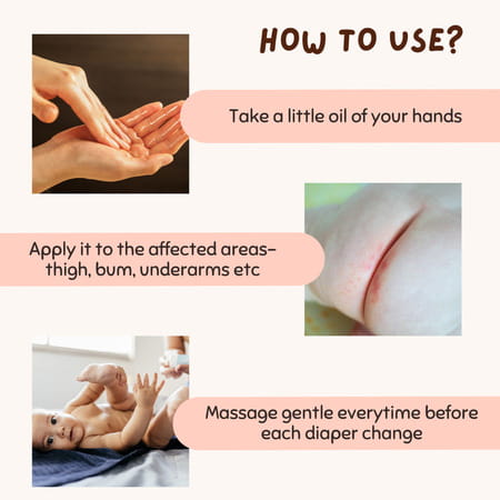 Coco Crush Rash Oil For Babies - Diaper & Nappy Rash Relief | Organic | Prevents Irritation - 50ml