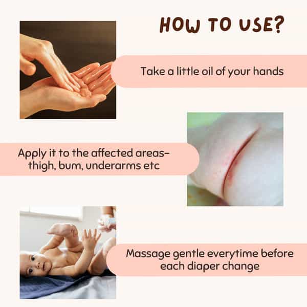 Coco Crush Rash Oil For Babies - Diaper & Nappy Rash Relief | Organic | Prevents Irritation - 50Ml