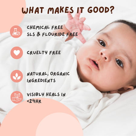 Coco Crush Rash Oil For Babies - Diaper & Nappy Rash Relief | Organic | Prevents Irritation - 50ml