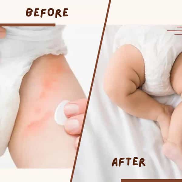 Coco Crush Rash Oil For Babies - Diaper & Nappy Rash Relief | Organic | Prevents Irritation - 50Ml