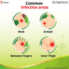 Tetmosol Plus Cream-Topical Antifungal Cream-Kills Fungus Relieves Itching And Skin Infections - 10G