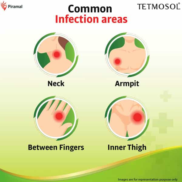 Tetmosol Plus Cream-Topical Antifungal Cream-Kills Fungus Relieves Itching And Skin Infections - 10G