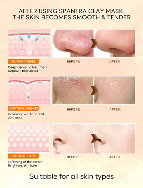 Spantra Vitamin C Clay Mask 125Gm