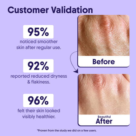 Aravi Organic 10% Aha + 1% Bha Exfoliating Body Lotion - 200ml