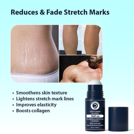 Dermistry Stretch Marks Scar Removal Roll On Oil Serum Pregnancy Safe With Shea Butter Bio Oils 50ml