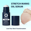 Dermistry Stretch Marks Scar Removal Roll On Oil Serum Pregnancy Safe With Shea Butter Bio Oils 50ml